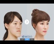 ID Hospital Korea Plastic Surgery