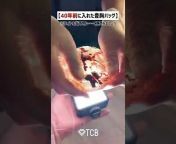 TCB公式チャンネル【美容整形・二重】