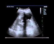 MGH Ultrasound