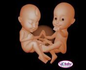 UC Baby 3D Ultrasound