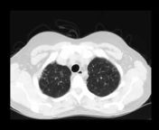 Radiology Case Videos