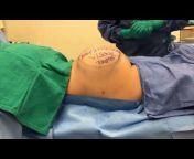 Facelift . Rhinoplasty . Blepharoplasty . Liposuction Toronto &#124; Visage Clinic