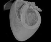 Three dimensional model of adult mouse heart