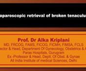 Laparoscopic removal of broken tenaculum; Prof Dr Alka Kriplani from tenaculum