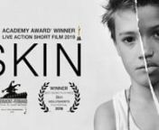 - Best Short Film at HollyShorts, Audience award at Clermont Film Festival - nnA small supermarket in a blue collar town, a black man smiles at a 10 year old white boy across the checkout aisle. This innocuous moment sends two gangs into a ruthless war that ends with a shocking backlash.nnIf you liked SKIN, discover the 2022 Oscar nominated shorts THE DRESS (vimeo.com/ondemand/thedress) and ALA KACHUU (vimeo.com/ondemand/alakachuu) nnSOCIAL NETWORKSnimdb.com/title/tt7332306/ nnCREWnDIRECTOR: Guy
