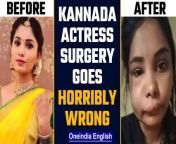 Kannada Actress Swathi Satish&#39;s root canal surgery goes wrong. The actress looks unrecognizable in her pictures that are making rounds on social media.&#60;br/&#62;&#60;br/&#62;#KannadaActress #SwathiSatish #RootCanal