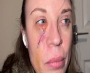 A mum says she was left looking like a &#92;